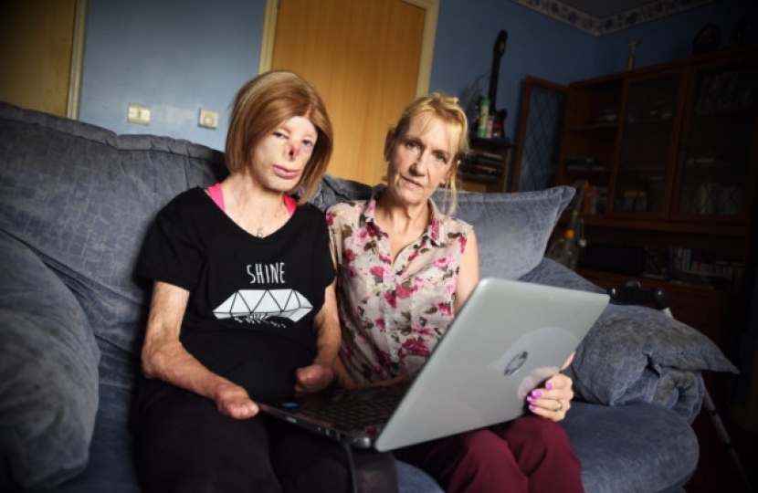 Terri Calvesbert, who was badly burned as a little girl, and her two friends launching an anti-bullying campaign. Left to right, Terri Calvesbert and Michelle Wright.