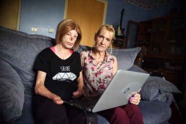 Terri Calvesbert, who was badly burned as a little girl, and her two friends launching an anti-bullying campaign. Left to right, Terri Calvesbert and Michelle Wright.